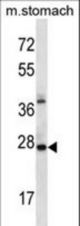 ALKBH4 Antibody western blot of mouse stomach tissue lysates (35 ug/lane). The ALKBH4 antibody detected the ALKBH4 protein (arrow).