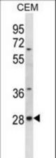 ALKBH4 Antibody western blot of CEM cell line lysates (35 ug/lane). The ALKBH4 antibody detected the ALKBH4 protein (arrow).