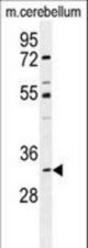 ALKBH6 Antibody western blot of mouse cerebellum tissue lysates (35 ug/lane). The ALKBH6 antibody detected the ALKBH6 protein (arrow).
