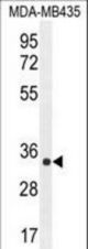 ALKBH6 Antibody western blot of MDA-MB435 cell line lysates (35 ug/lane). The ALKBH6 antibody detected the ALKBH6 protein (arrow).