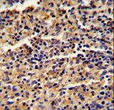 Formalin-fixed and paraffin-embedded human spleen reacted with ALKBH8 Antibody , which was peroxidase-conjugated to the secondary antibody, followed by DAB staining. This data demonstrates the use of this antibody for immunohistochemistry; clinical relevance has not been evaluated.