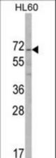 Western blot of ALKBH8 Antibody in HL60 cell line lysates (35 ug/lane). ALKBH8 (arrow) was detected using the purified antibody.