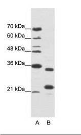 A: Marker, B: Jurkat Cell Lysate