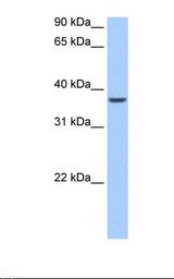 Liver cell lysate. Antibody concentration: 0.5 ug/ml. Gel concentration: 12%.