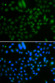 Immunofluorescence blot of A549 cell using ALKBH8 antibody. Blue: DAPI for nuclear staining.