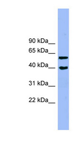 ALLC antibody LS-C112009 Western blot of Jurkat lysate.