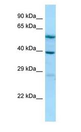 ALLC antibody Western Blot of Jurkat.
