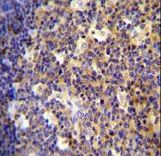 ALOX12B antibody immunohistochemistry of formalin-fixed and paraffin-embedded human tonsil tissue followed by peroxidase-conjugated secondary antibody and DAB staining.