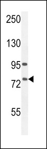 ALOX12B Antibody western blot of A549 cell line lysates (35 ug/lane). The ALOX12B antibody detected the ALOX12B protein (arrow).