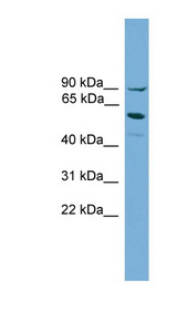 ALOX15B / 15 Lipoxygenase 2 antibody LS-C117046 Western blot of HepG2 cell lysate.