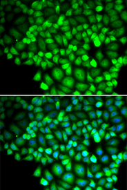Immunofluorescence blot of HeLa cell using ALOX15B antibody. Blue: DAPI for nuclear staining.