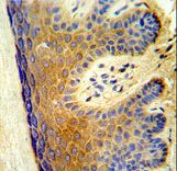 Formalin-fixed and paraffin-embedded human skin tissue reacted with ALOX15B Antibody ,which was peroxidase-conjugated to the secondary antibody, followed by DAB staining. This data demonstrates the use of this antibody for immunohistochemistry; clinical relevance has not been evaluated.