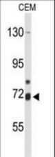 Western blot of ALOX15B Antibody in CEM cell line lysates (35 ug/lane). ALOX15B (arrow) was detected using the purified antibody.