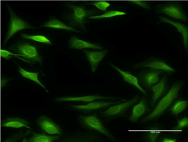 Immunofluorescence of monoclonal antibody to ALOX15B on HeLa cell . [antibody concentration 10 ug/ml]