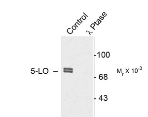 Western blot of rat cortex lysate showing specific immunolabeling of the ~80k doublet of 5-LO phosphorylated at Ser523 (Control). The phosphospecificity of this labeling is shown in the second lane (lambda-phosphatase: lambda-phosphatase). The blot is ide