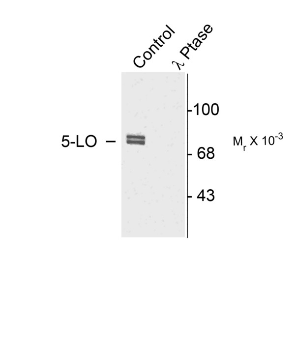 Western blot of rat cortex lysate showing specific immunolabeling of the ~80k doublet of 5-LO phosphorylated at Ser523 (Control). The phosphospecificity of this labeling is shown in the second lane (lambda-phosphatase: l-Ptase). The blot is identical to the control except that it was incubated in l-Ptase (1200 units for 30 min) before being exposed to the Anti-Ser523 5-LO. The immunolabeling is completely eliminated by treatment with l-Ptase.