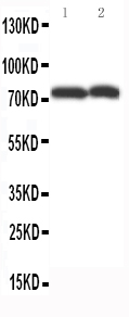 WB of ABCG4 antibody. All lanes: Anti-ABCG4 at 0.5ug/ml. Lane 1: Rat Brain Tissue Lysate at 40ug. Lane 2: Mouse Brain Tissue Lysate at 40ug. Predicted bind size: 74KD. Observed bind size: 74KD.