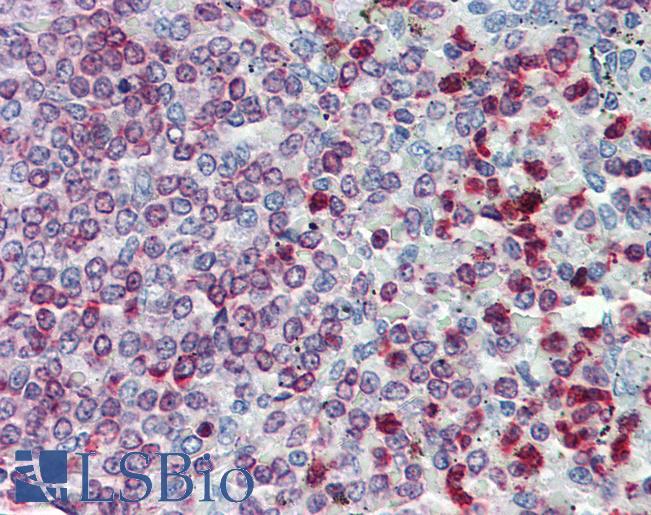 Anti-ALOX5AP / FLAP antibody IHC of human spleen. Immunohistochemistry of formalin-fixed, paraffin-embedded tissue after heat-induced antigen retrieval. Antibody LS-B4069 concentration 10 ug/ml.