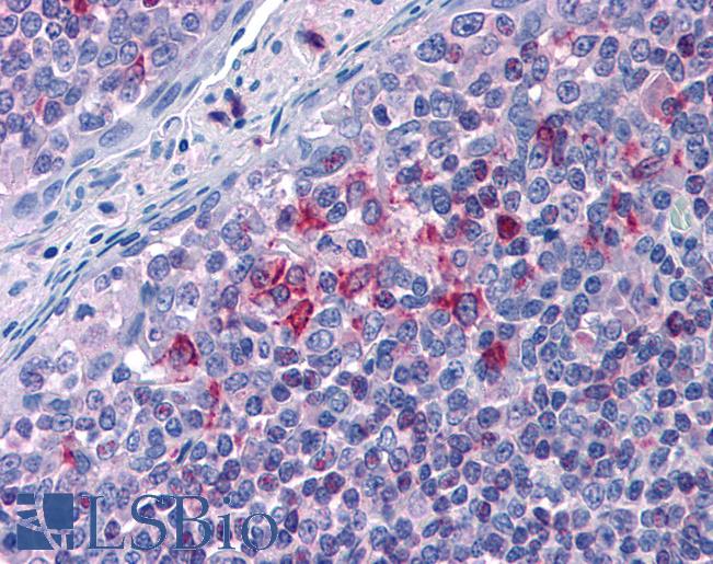 Anti-ALOX5AP / FLAP antibody IHC of human tonsil. Immunohistochemistry of formalin-fixed, paraffin-embedded tissue after heat-induced antigen retrieval. Antibody LS-B4971 concentration 3.75 ug/ml.