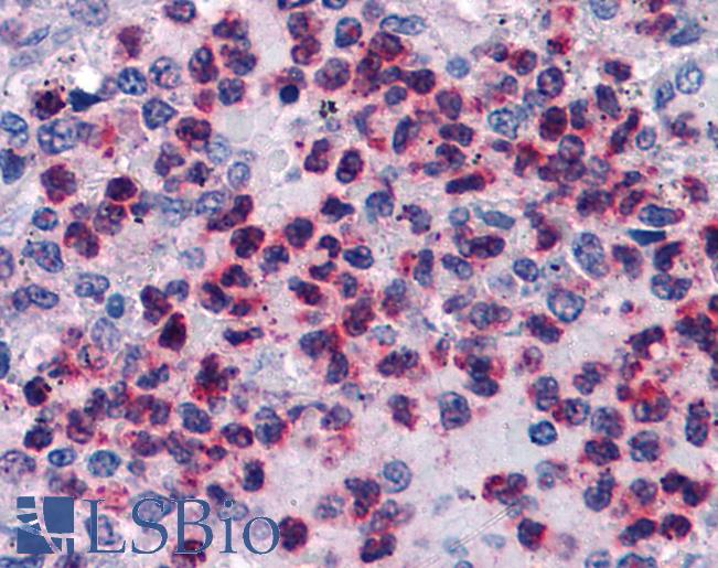 Anti-ALOX5AP / FLAP antibody IHC of human spleen. Immunohistochemistry of formalin-fixed, paraffin-embedded tissue after heat-induced antigen retrieval. Antibody LS-B4971 concentration 3.75 ug/ml.