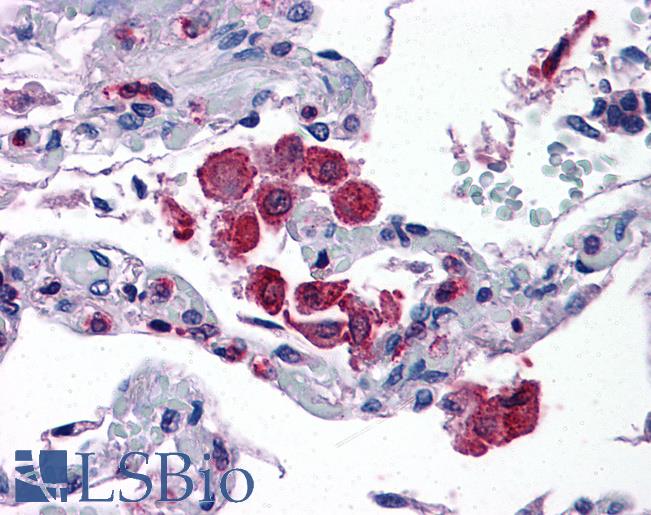 Anti-ALOX5AP / FLAP antibody IHC of human lung. Immunohistochemistry of formalin-fixed, paraffin-embedded tissue after heat-induced antigen retrieval. Antibody LS-B4971 concentration 3.75 ug/ml.