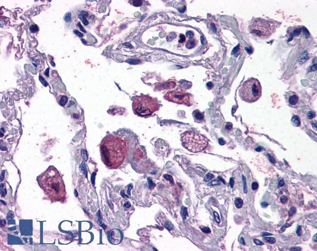 Anti-ALOX5AP / FLAP antibody IHC of human lung. Immunohistochemistry of formalin-fixed, paraffin-embedded tissue after heat-induced antigen retrieval. Antibody LS-B4933 concentration 3.75 ug/ml.