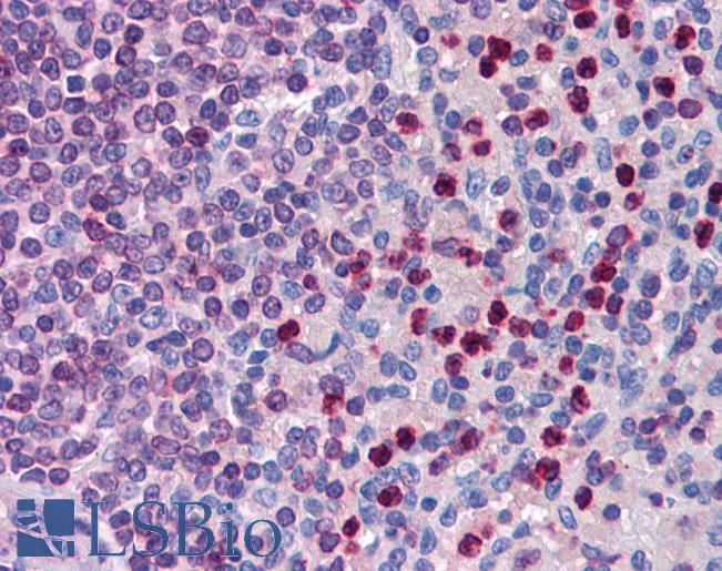 Anti-ALOX5AP / FLAP antibody IHC of human spleen. Immunohistochemistry of formalin-fixed, paraffin-embedded tissue after heat-induced antigen retrieval. Antibody LS-B4933 concentration 3.75 ug/ml.