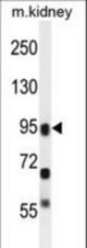 ALOXE3 Antibody western blot of mouse kidney tissue lysates (35 ug/lane). The ALOXE3 antibody detected the ALOXE3 protein (arrow).