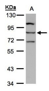 Sample (30 ug whole cell lysate). A: Hep G2 . 7.5% SDS PAGE. ALOXE3 antibody diluted at 1:1000