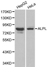 Western blot of ALPL pAb in extracts from HepG2 and Hela cells.