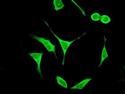 Immunofluorescent staining of HeLa cells using anti-ALPL antibody.
