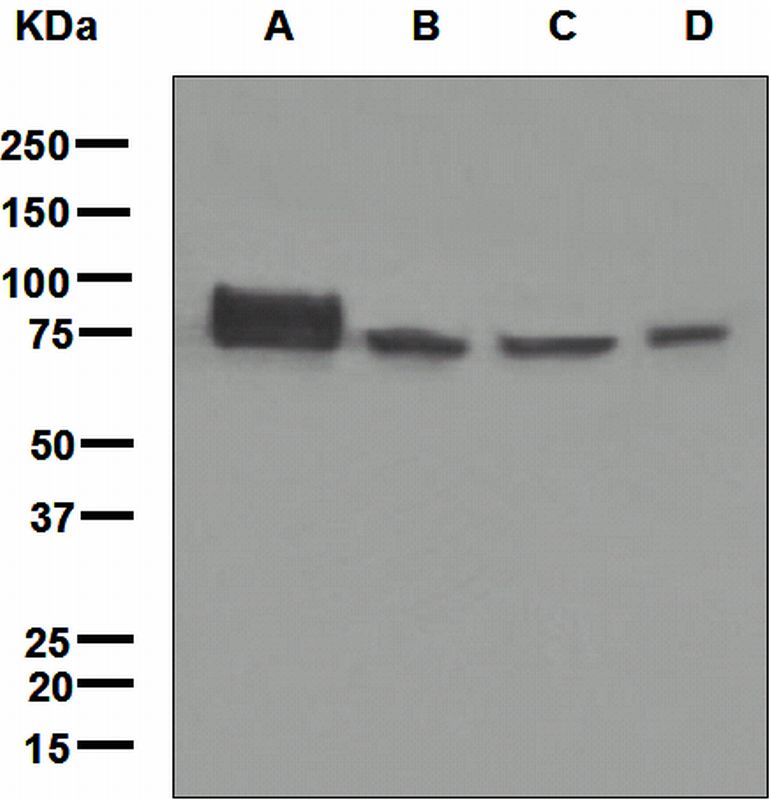 Western blot analysis on (A) SAOS-2, (B) HepG2, (C) HeLa, and (D) JAR cell lysates using anti-ALPL antibody.