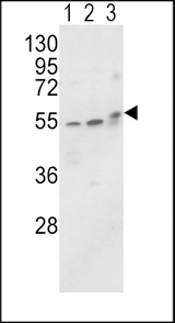 Western blot of ALPL Antibody in MCF-7(lane 1),HL-60 cell line(lane 2) and mouse brain tissue(lane 3) lysates (35 ug/lane). ALPL (arrow) was detected using the purified antibody.