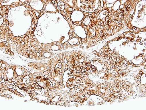 IHC of paraffin-embedded Breast using ALPPL2 antibody at 1:500 dilution.