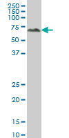 ALPPL2 monoclonal antibody (M07), clone 2B3 Western blot of ALPPL2 expression in A-431.