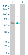 Western blot of ALPPL2 expression in transfected 293T cell line by ALPPL2 monoclonal antibody (M07), clone 2B3.