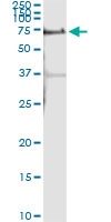 Immunoprecipitation of ALPPL2 transfected lysate using anti-ALPPL2 monoclonal antibody and Protein A Magnetic Bead.