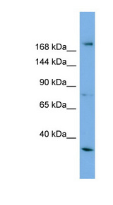 ALS2 antibody LS-C110908 Western blot of HepG2 cell lysate.