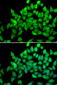Immunofluorescence blot of A549 cell using ALS2 antibody. Blue: DAPI for nuclear staining.
