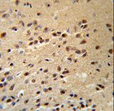 ALS2 Antibody (RB18853) IHC of formalin-fixed and paraffin-embedded human brain tissue followed by peroxidase-conjugated secondary antibody and DAB staining.