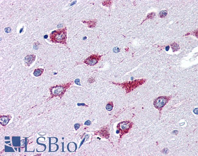 Anti-ALS2 antibody IHC of human brain, cortex. Immunohistochemistry of formalin-fixed, paraffin-embedded tissue after heat-induced antigen retrieval. Antibody LS-B2740 concentration 75 ug/ml.