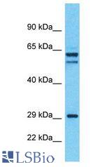 ALS2CL antibody Western Blot of 293T. Antibody dilution: 1 ug/ml.