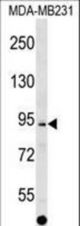 ALS2CL Antibody western blot of MDA-MB231 cell line lysates (35 ug/lane). The ALS2CL antibody detected the ALS2CL protein (arrow).