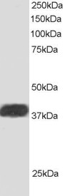 Antibody staining (1 ug/ml) of Human Heart lysate (RIPA buffer, 30 ug total protein per lane). Primary incubated for 1 hour. Detected by Western blot of chemiluminescence.