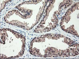 IHC of paraffin-embedded Human prostate tissue using anti-NIF3L1 mouse monoclonal antibody.