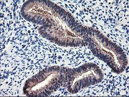 IHC of paraffin-embedded Human endometrium tissue using anti-NIF3L1 mouse monoclonal antibody.