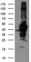 HEK293T cells were transfected with the pCMV6-ENTRY control (Left lane) or pCMV6-ENTRY NIF3L1 (Right lane) cDNA for 48 hrs and lysed. Equivalent amounts of cell lysates (5 ug per lane) were separated by SDS-PAGE and immunoblotted with anti-NIF3L1.