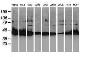 Western blot of extracts (35 ug) from 9 different cell lines by using anti-NIF3L1 monoclonal antibody.