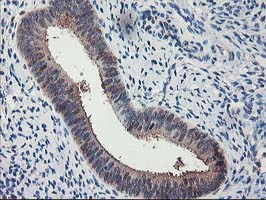 IHC of paraffin-embedded Human endometrium tissue using anti-NIF3L1 mouse monoclonal antibody.