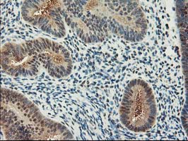 IHC of paraffin-embedded Human endometrium tissue using anti-NIF3L1 mouse monoclonal antibody.